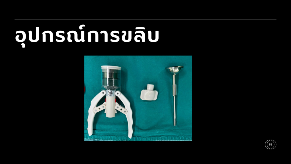 รีวิวขลิบไร้เลือด ที่ Lover Clinic โคราช คลินิกสุขภาพเพศชายครบวงจร