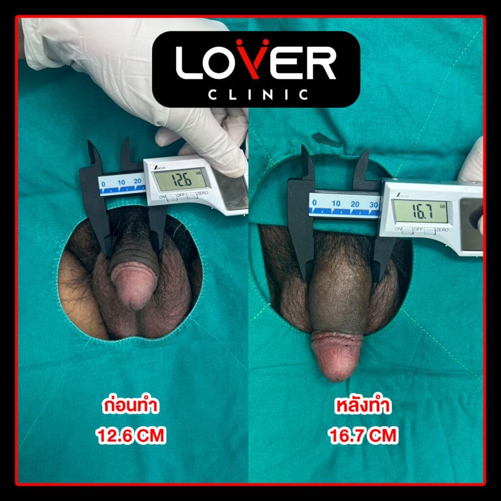 ลงเว็บ 2