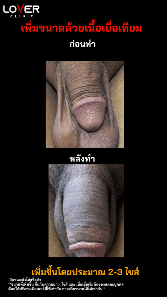 เนื้อเยื่อเทียม1