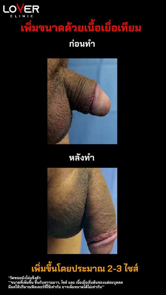 เนื้อเยื่อเทียม2 540x960 1