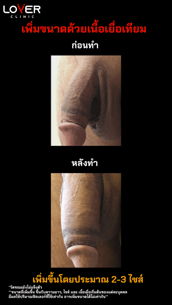 เนื้อเยื่อเทียม3