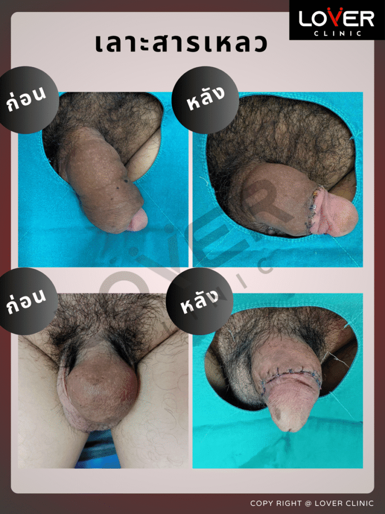 เลาะสารเหลว4 900x1200 1
