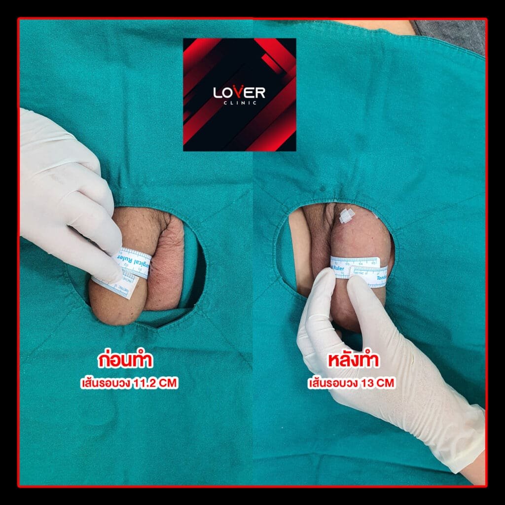 เฮียศํกดิ์ ลงเว็บ