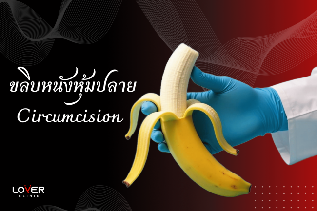 ไขข้อข้องใจ ขลิบไร้เลือดกับขลิบธรรมดาต่างกันอย่างไร? ข้อดี-ข้อเสีย เลือกแบบไหนดี? พร้อมแนะนำคลินิกขลิบที่โคราช อ่านเลย!